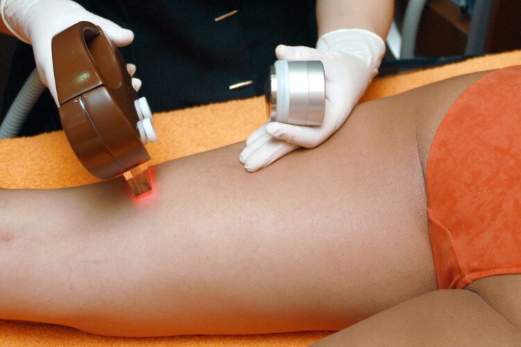 Laser Hair Removal Over Waxing