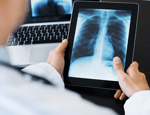 X-Ray With an Online Consultation